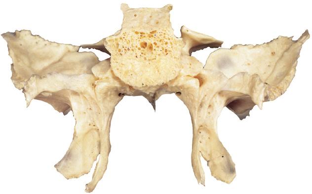 Canalis pterygoideus Facies maxillaris b Vooraanzicht Sulcus hamuli pterygoidei Concha sphenoidalis Lamina lateralis van de processus Lamina medialis pterygoideus Hamulus