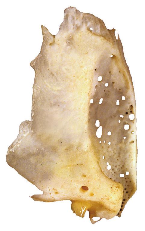 Traanbeen 2.18 Traanbeen rechts (os lacrimale), aanzicht voor-lateraal.
