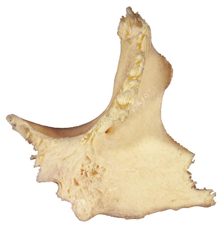 orbitalis Facies orbitalis Tuberculum orbitale Facies lateralis Foramen