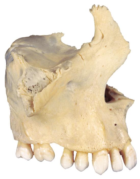 Bovenkaak 2.23a,b Bovenkaak rechts (maxilla).