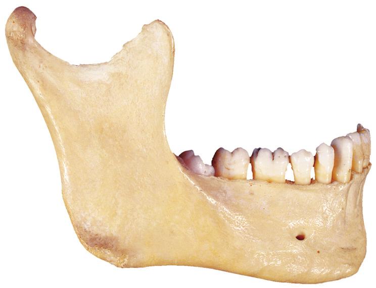 Onderkaak 2.24 Onderkaak met volledig gebit (mandibula), aanzicht rechts-lateraal.