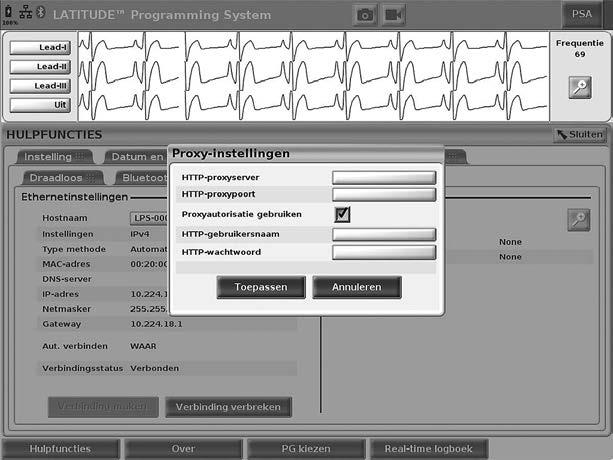 Hulpfuncties - Netwerk instellen - Draadloos - Ethernet en Proxy Afbeelding 14.