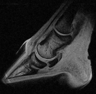 Figuur 25: MRI beeld van de rechter voet,