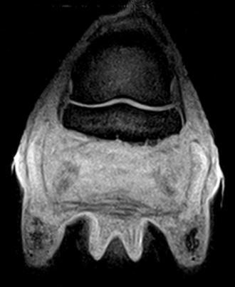 Figuur 34: MRI beeld van de rechter voet,