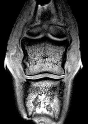 Figuur 35: MRI beeld van de rechter voet,