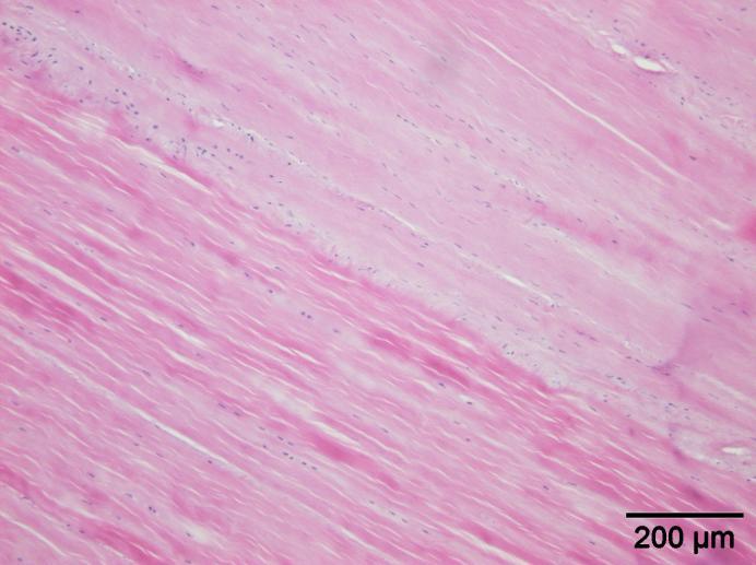 Het peesweefsel dat normaal relatief celarm hoort te zijn bevat zones met een duidelijk verhoogd aantal fibroblasten (figuur 69). De dorsale rand vertoont duidelijk letsels (figuur 69).