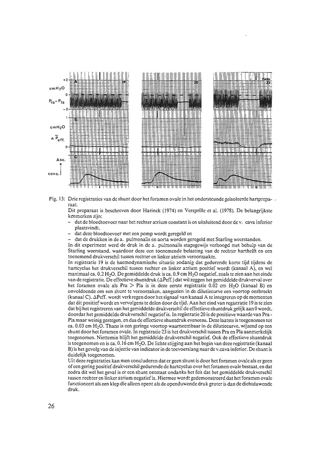 Fig. 13: Drie registraties van de shunt door het foramen ovale in het ondersteunde geïsoleerde hartprcparaat. Dit preparaat is beschreven door Harinck (1974) en Versprille et al. (1978).