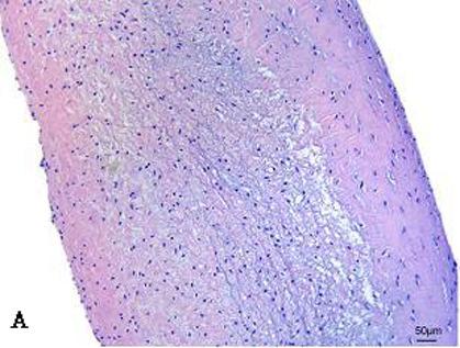 Resultaten. Figuur 12: Macroscopisch beeld van het detergent-osmotisch (A) en het enzymatisch- osmotisch (B) gedecellulariseerd klepblad. 4.1.2. Microscopische analyse na decellularisatie 4.