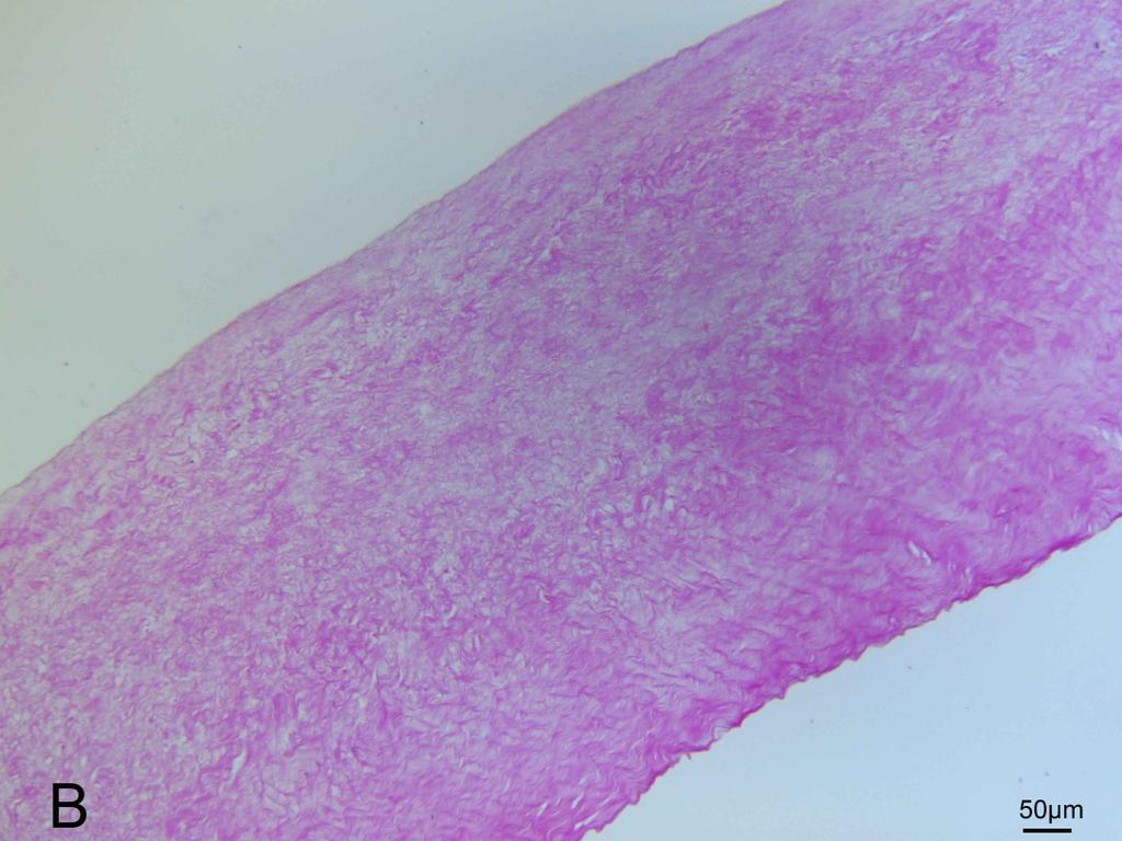 2.1.2 Enzymatische decellularisatie Na de enzymatische decellularisatie was de lamina spongiosa nagenoeg volledig acellulair, zoals te zien op figuur 14A.