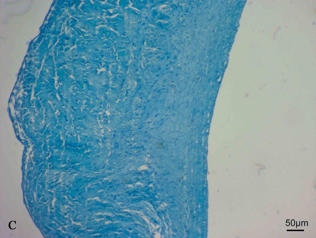 De referentiewaarde voor de maximale kracht tot perforatie van een porcien aortaklepblad is 15,8 +/- 3,11 N (stresspositief) of 17,5 +/- 2,84 N (stressnegatief), afhankelijk van het stressgenotype