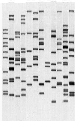 Restriction Fragment Length Polymorphism typing (RFLP), vanaf 1993 Typering voor de detectie van TB transmissie Insertion element 6110, specifiek voor M.