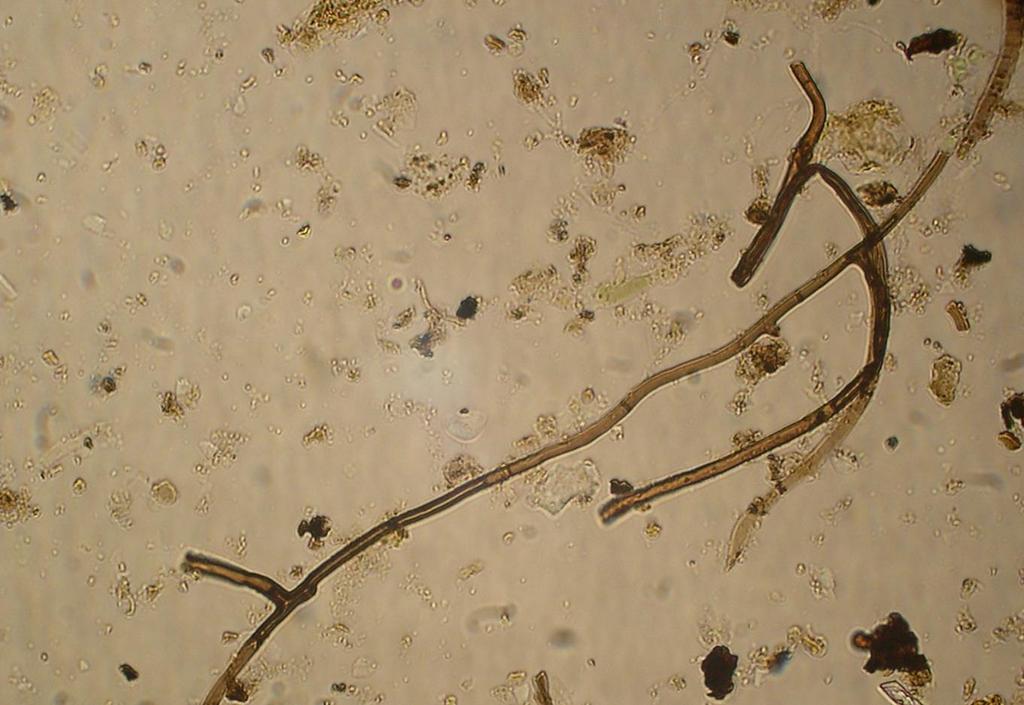 Gekleurde (hyaline) en ongekleurde (melanine) schimmels Melanine is donker pigment in celwanden bescherming tegen stress: straling, hitte,