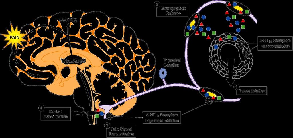 Neurovasculaire hoofdpijn vasculaire hypothese obsoleet