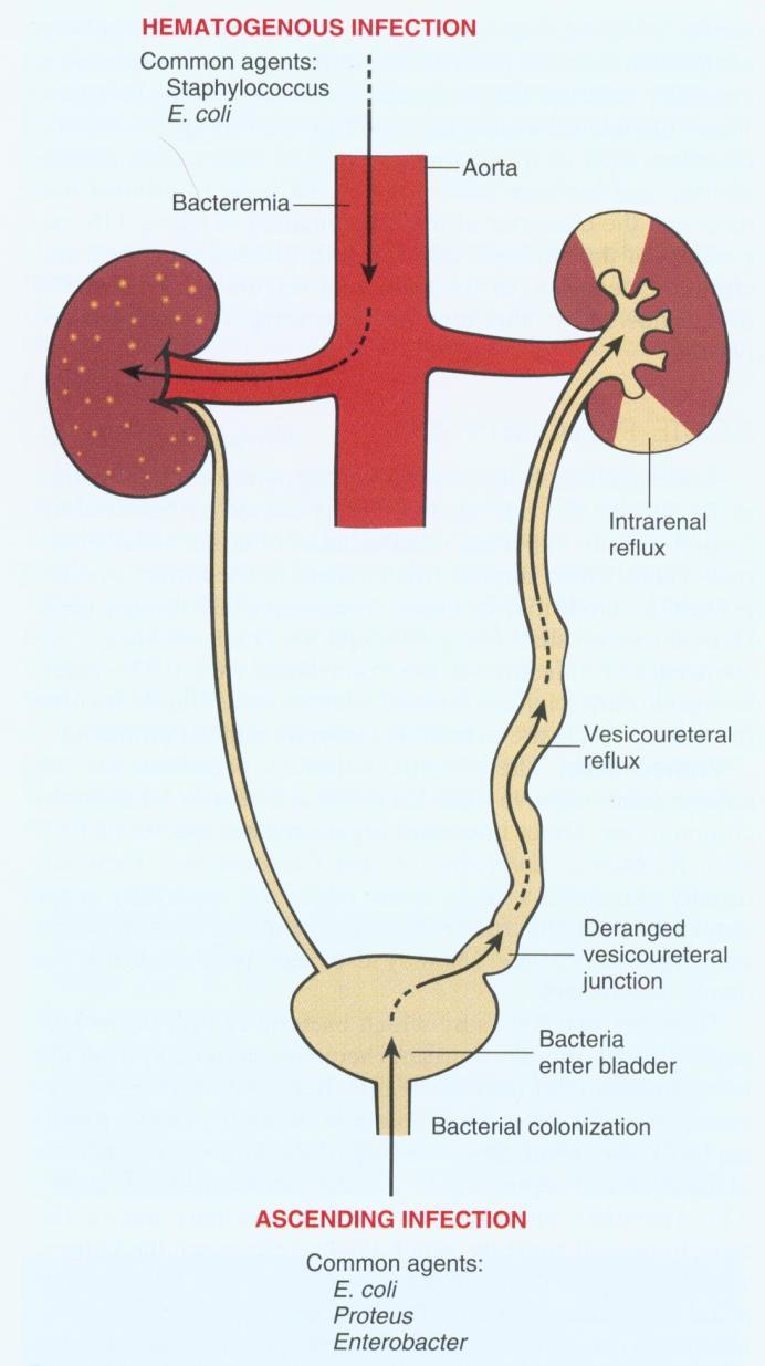 Pathogenese en pathologie Opstijgend: