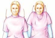 Oefening 1 Bij deze oefening uw armen langs uw lichaam laten hangen. Vervolgens een aantal keren uw schouders optrekken en laten zakken.