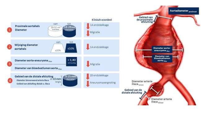 Bijlage 1: Herinnering updates instructies voor gebruik (IFU) In de FSN van oktober 2016 deelde Endologix mee dat de instructies voor gebruik (IFU) voor het Nellixsysteem werden bijgewerkt op de