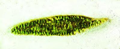 de Hel 2012 Fig. 5.4. Mixotrofe Ciliaat. Mixotrofe vertegenwoordiger van het geslacht Stichtricha. Uit tabel 5.2 blijkt dat het aantal waargenomen soorten in 2011 niet erg verschilt van dat in 2011.