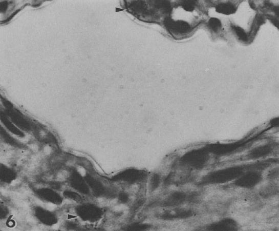Een gelabelde leukocyt (pijlpunt) is te zien in het lumen van een kleine vene van de maagwand. Vergroting: 2100x (naar Seelig and Head 1987).