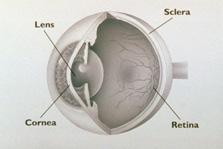 Keratoconus Het hoornvlies en zien Het hoornvlies (cornea) is een doorzichtig en kleurloos weefsel dat het venster van het oog vormt.