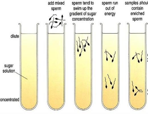 Y chromosoom-bevattend sperma X chromosoom-bevattend sperma Y