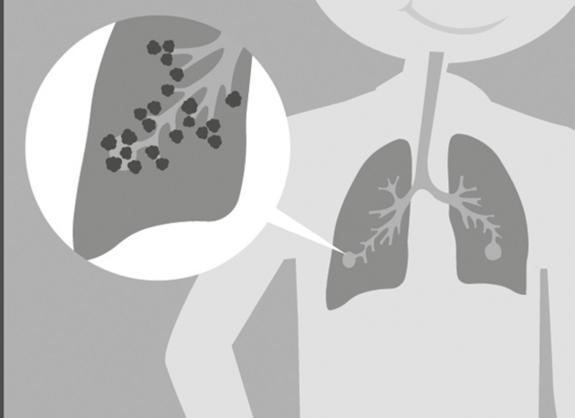 Je longen Ademen met je longen Iedereen heeft twee longen: ze zitten in je borst naast je hart. Daarmee haal je adem. Je krijgt lucht binnen. In lucht zit zuurstof.