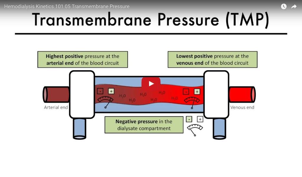 Transmembrane pressure TMP high =
