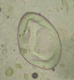 Paramphistomum species worden wel in hogere mate uitgescheiden dan die van Fasciola hepatica (Mage en Dorchies, 1998). A B Fig.
