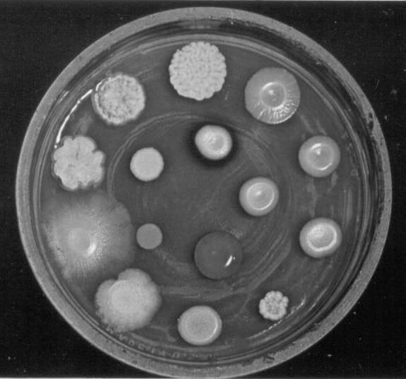 HOOFDSTUK 18: controle van de microbiële groei 18.1 Warmtesterilisatie 18.2 Sterilisatie door straling 18.3 Filter sterilisatie 18.4 Chemische controle van microbiële groei 18.