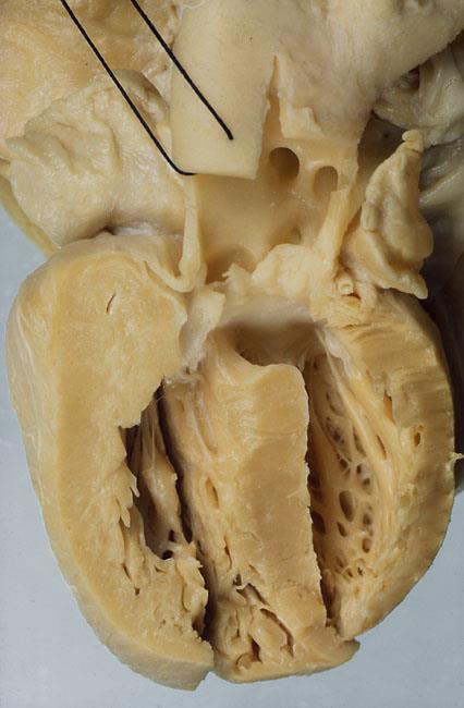grote vaten (aorta en truncus pulmonalis) 2.