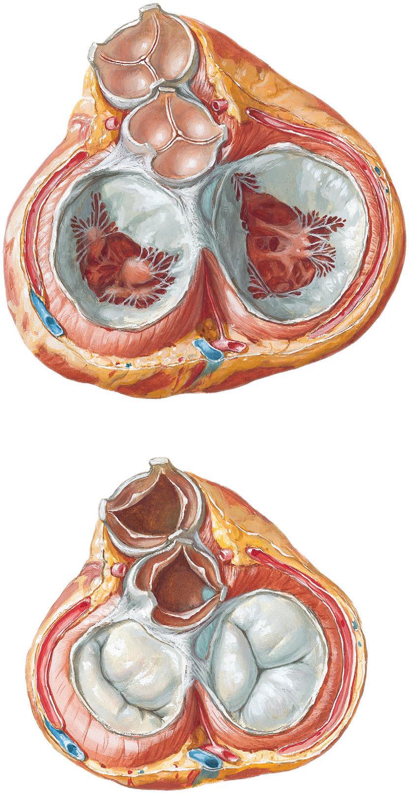 Hartskelet pulmonaalklep aortaklep tricuspidaalklep mitraalklep 36 NIBI congres