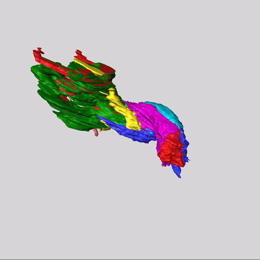 Neural Crest (wntcre x mtmg) and Second Heart Field (nkx2.