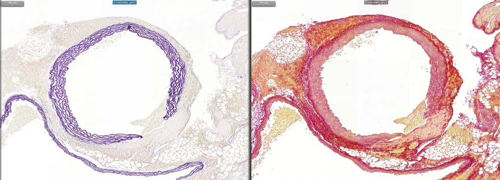 20% van de adulte muizen knock out voor NO-synthase heeft een