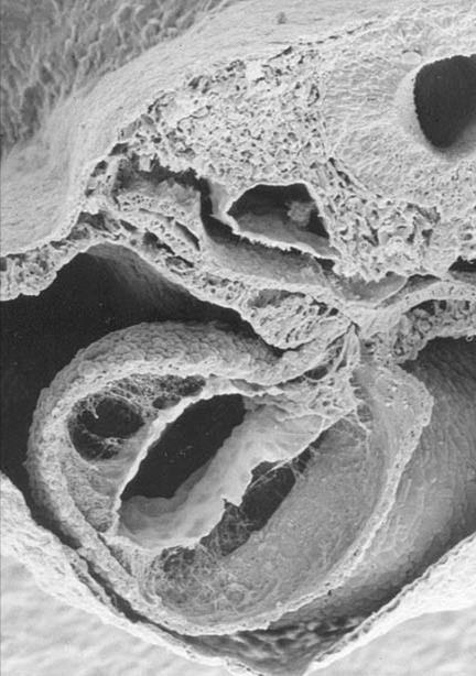 ENDOCARDIAL CUSHION CELLS CARDIAC JELLY