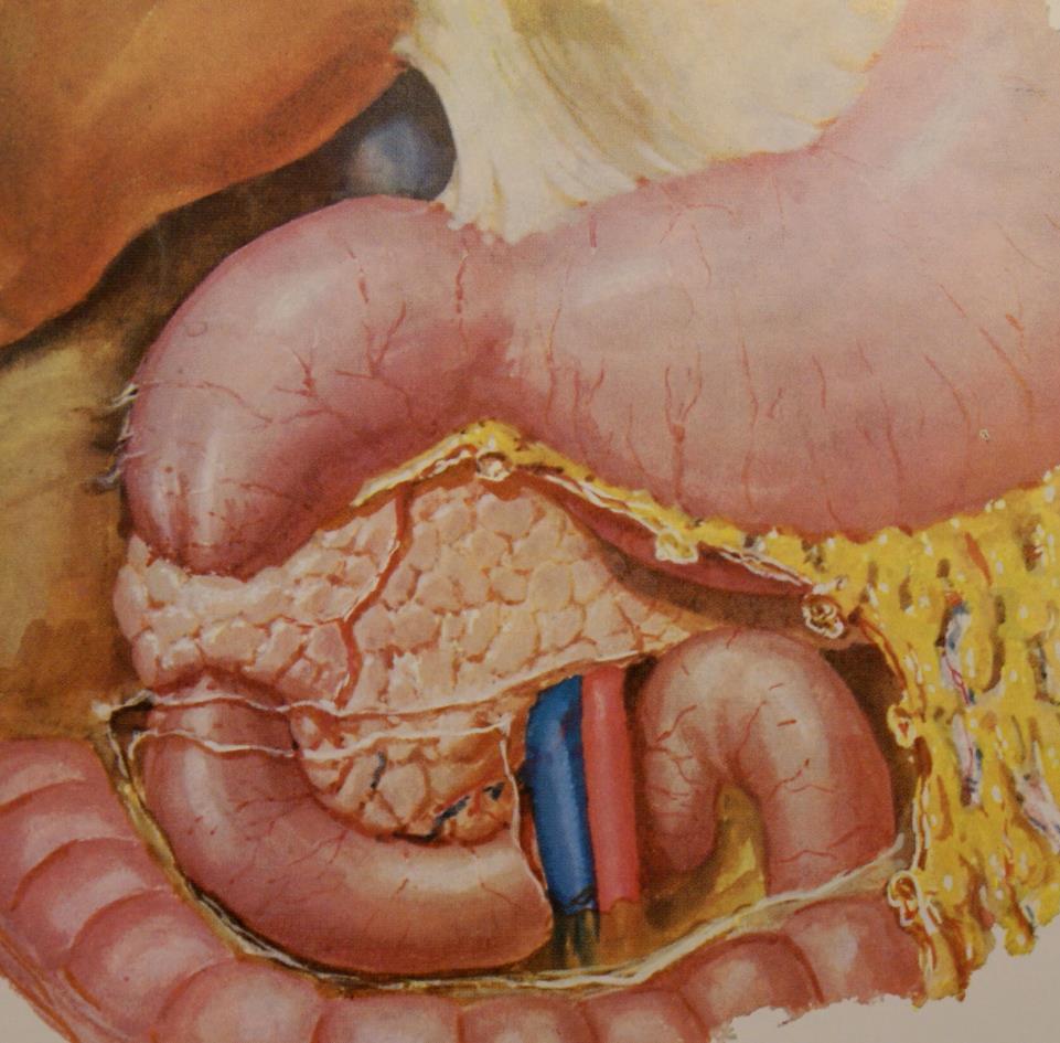 Neonataal abdomen Subtotale duodenum obstructie