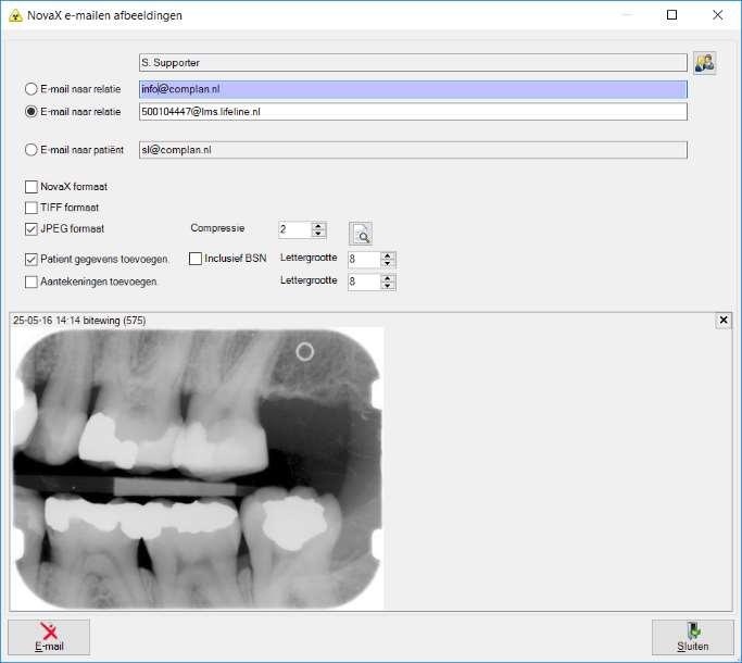 Bij uw relaties kunt u twee email adressen ingeven. U zet een stipje voor het e-mailadres dat u wilt gebruiken. Het is ook mogelijk de foto's naar de patiënt zelf te mailen.