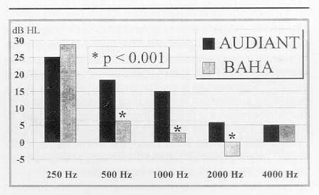 Audiant vs BAHA AUDIANT (n=7) BAHA (n=30) BC/AC 10/62 30/74 ABG closure 14 db 2 db