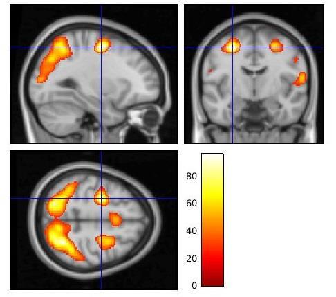 zien in welke hersengebieden meer of minder activatie is tijdens (1) de werkgeheugencondities ten opzichte van de controlecondities, of (2) de complexe condities ten opzichte van de eenvoudige