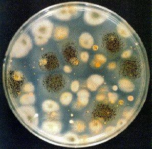 Voorbeelden van bacteriekolonies: Bijlage 8D Bronvermelding Kemmers, P. en Van Graft, M. (2007).