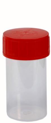 container of UriSwab voor urinesneltest Om een optimale leefbaarheid van de micro-organismen te behouden, is het aanbevolen om het materiaal zo snel mogelijk naar het laboratorium te