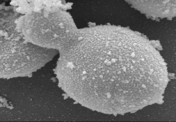 3. Practicum: Cellen van gist, mos en alg Facultatief practicum. Doel Het observeren van diverse vormen van eencelligen en cellen van meercellige mossen.
