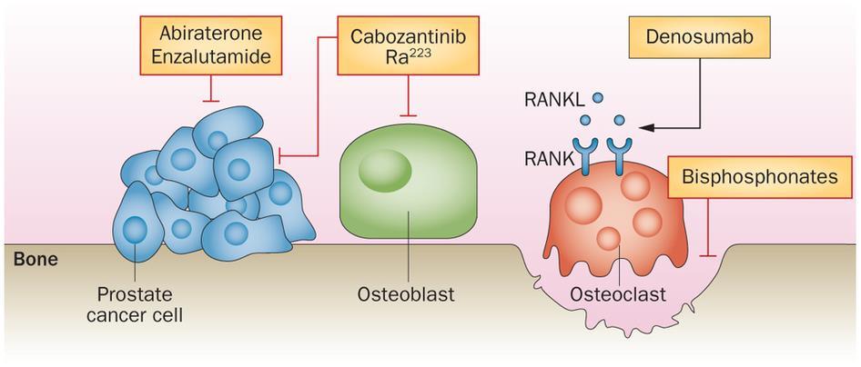 Treatments after docetaxel progression