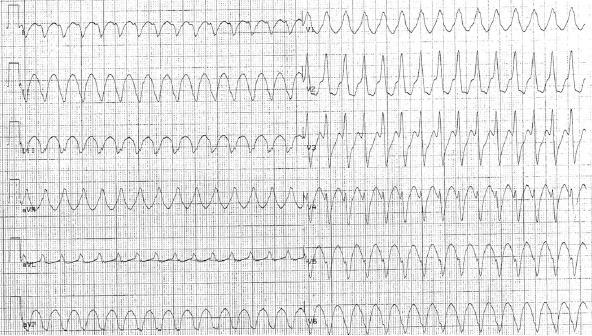 ECG 195 ECG 196