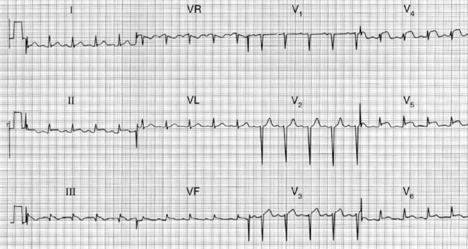 ECG 104: M 25j,