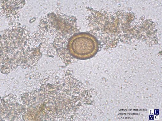 2017-1 Monster D Taenia spp, Giardia lamblia 16 van de 81 deelnemers: doorgestuurd naar elders 9 geen uitslag