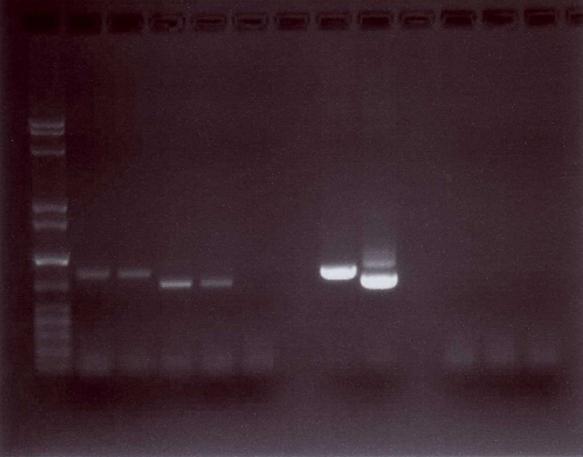 Tsag Tsol Tsag Tsol COST action ringtrial Taenia sept 2017 Taenia species multiplex PCR*.