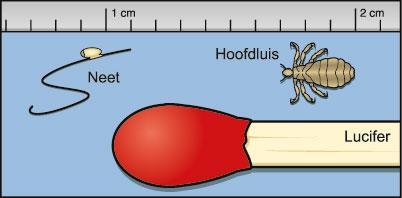 gekleurde spikkels. Wanneer u zonder kammen controleert, is de kans groot dat u luizen mist. Als er luizen zijn ontdekt, wat dan?