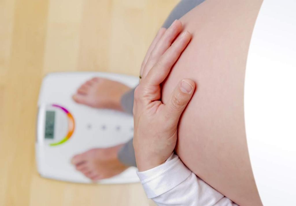 Adviesrichtlijn Zwangerschap na bariatrische chirurgie Madelène Kuipers, arts Nederlandse