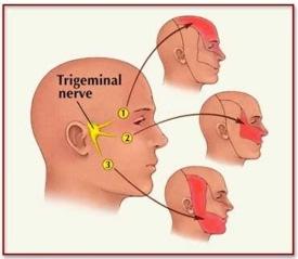 behandeling trigeminusneuralgie medicatie zenuwblokkade