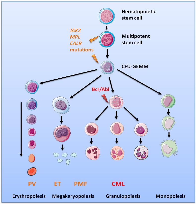 Autonome trombocytose Onderliggende beenmergziekte CML = chronische myeloide leukemie (BCR-ABL) PMF = primaire