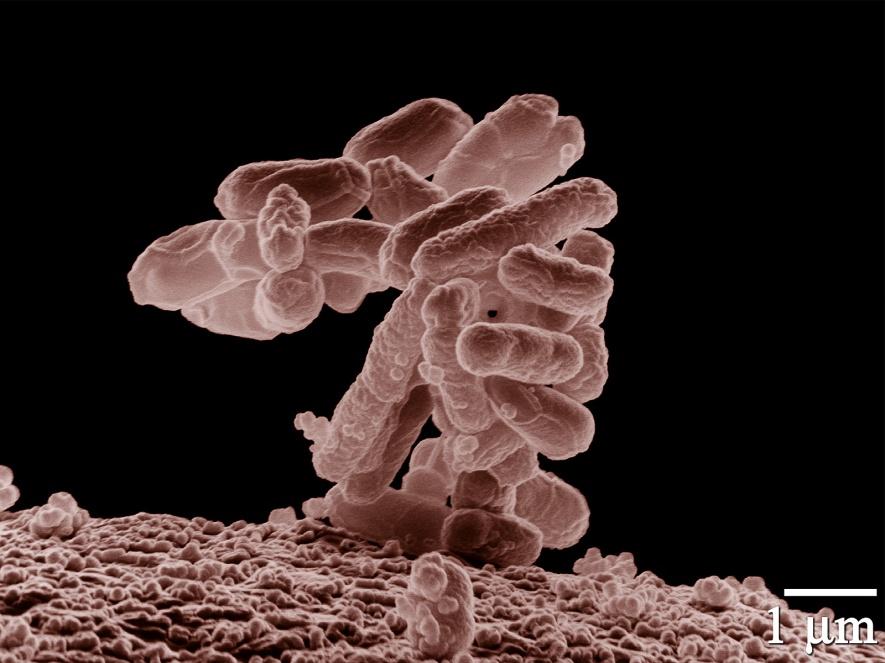 e.coli. Een van de veel voorkomende bacteriën in de dikke darm is de E. Coli bacterie.